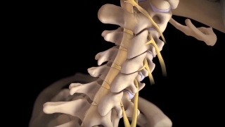 医学宣传动画-脊椎脊柱手术·医学宣传动画